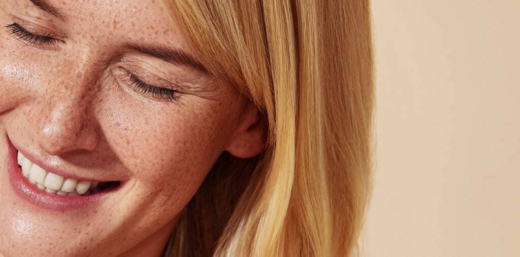 пігментні плями